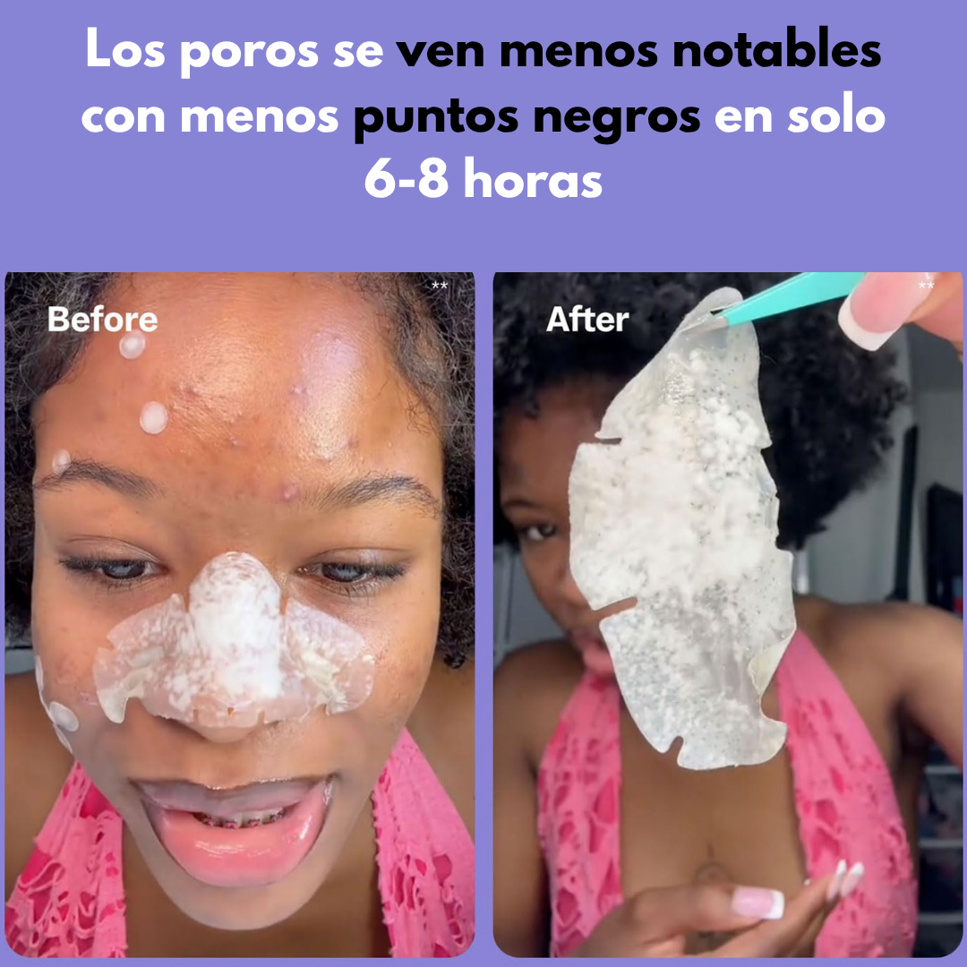 Parches limpiadores para poros